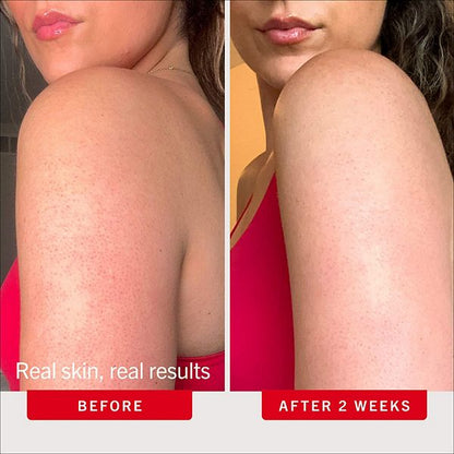 First Aid Beauty Mini KP Bump Eraser 10% AHA Bədən Eksfoliantı