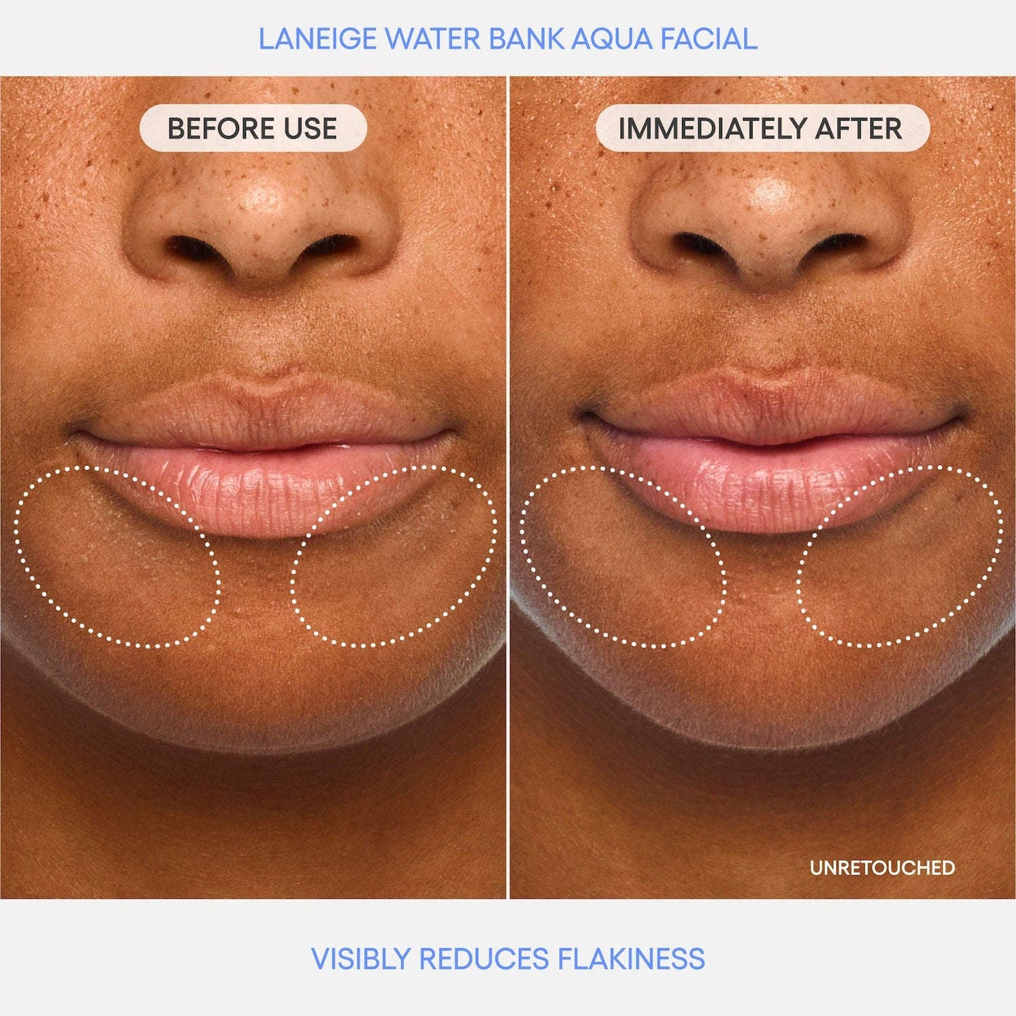 LANEIGE Water Bank Aqua Facial Serum BHA + AHA Serumu YoxYox