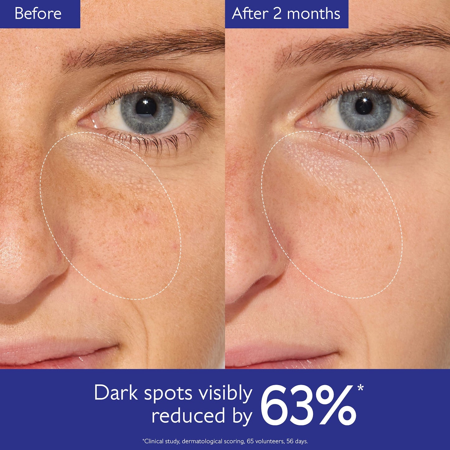Caudalie Vinoperfect Parlaqlıq Kərə Ləkəsi Serumu Vitamin C Alternatiви