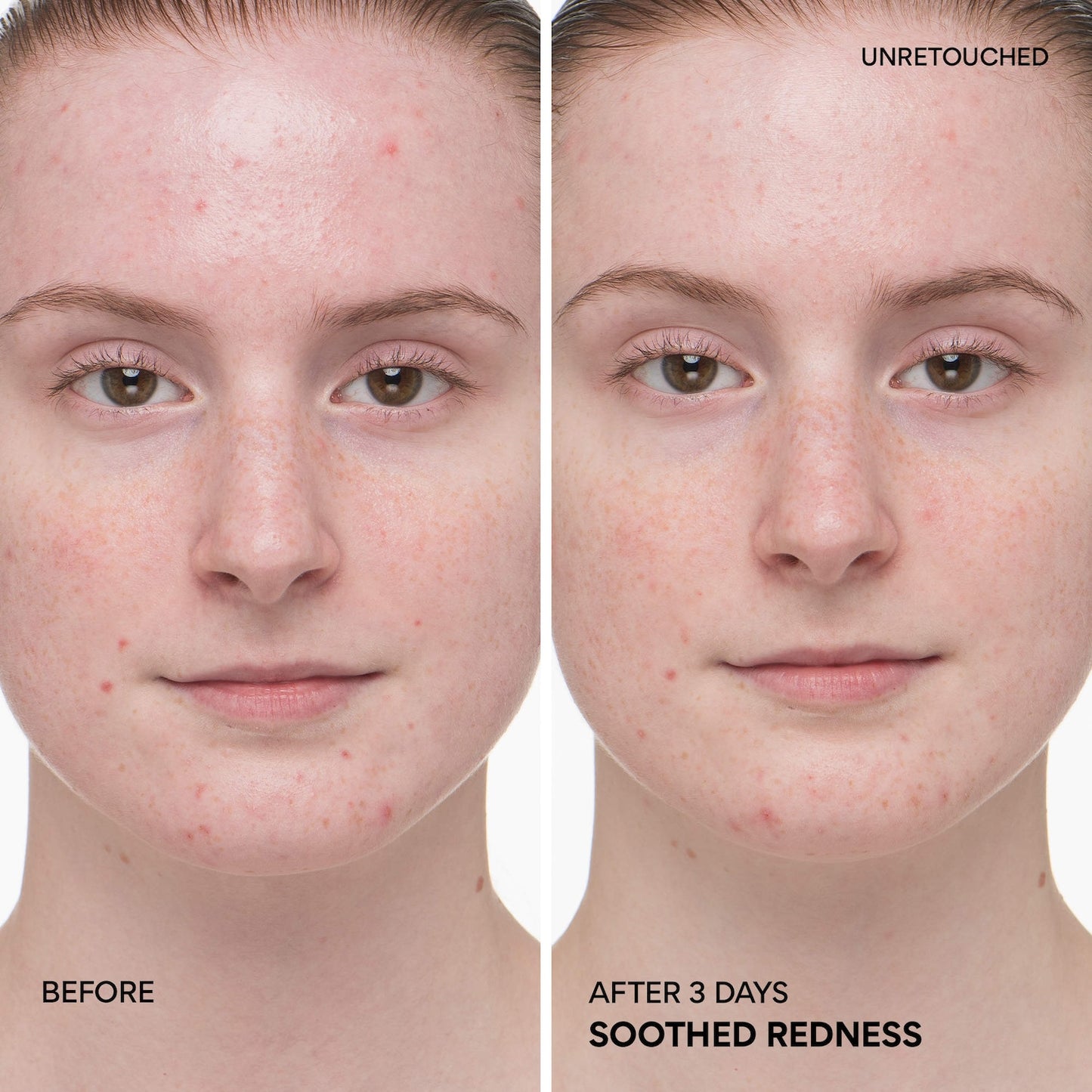 innisfree Mini Yaşıl Çay Ceramide Süt Tonikü Hidratasyon və Bariyer Onarması üçün