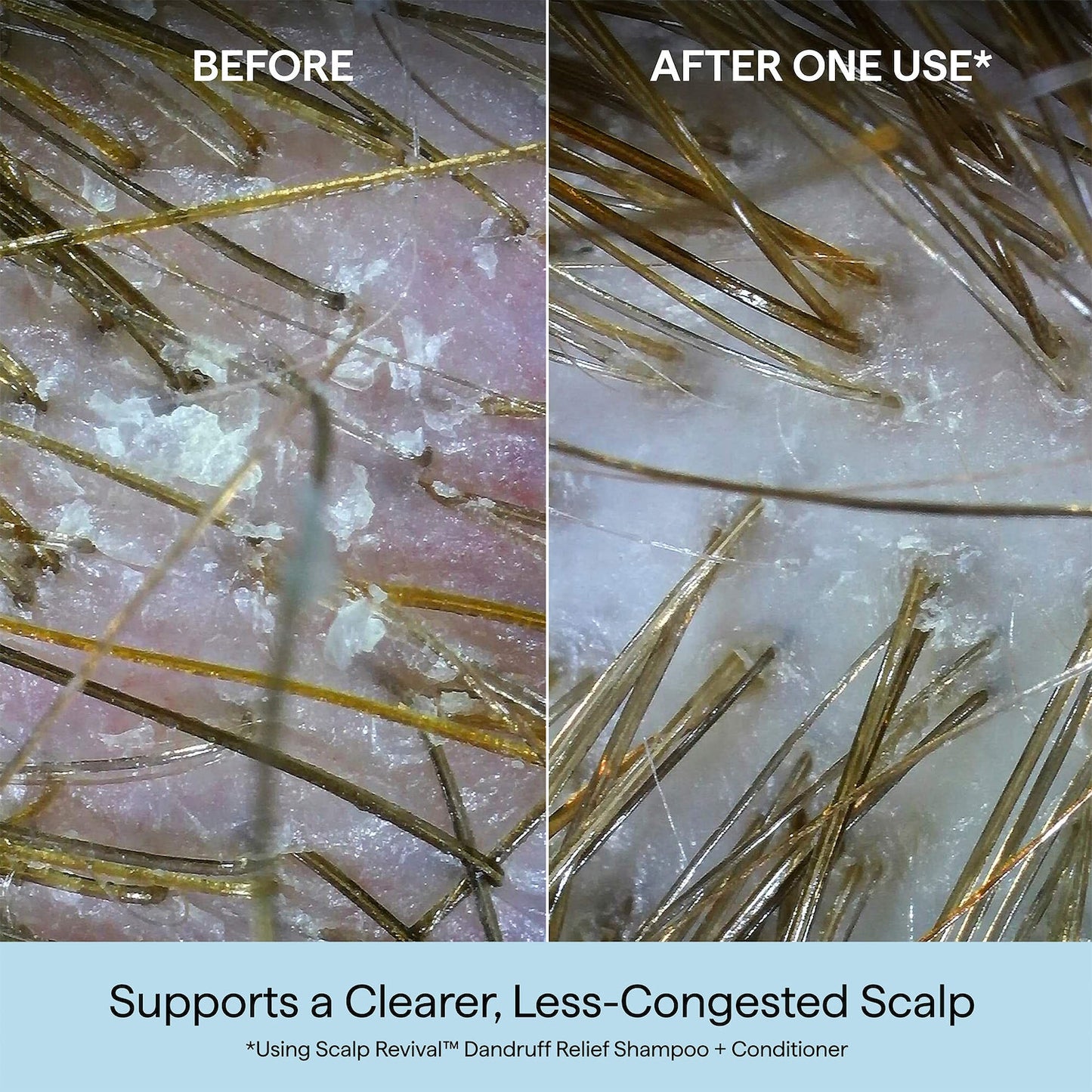 Briogeo Scalp Revival™ Kəpəkli Saçlar Üçün Şampun Salisilik Turşu ilə
