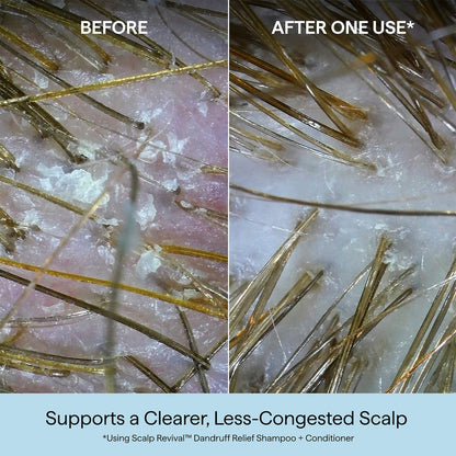 Briogeo Scalp Revival™ Kəpəkli Saçlar Üçün Şampun Salisilik Turşu ilə