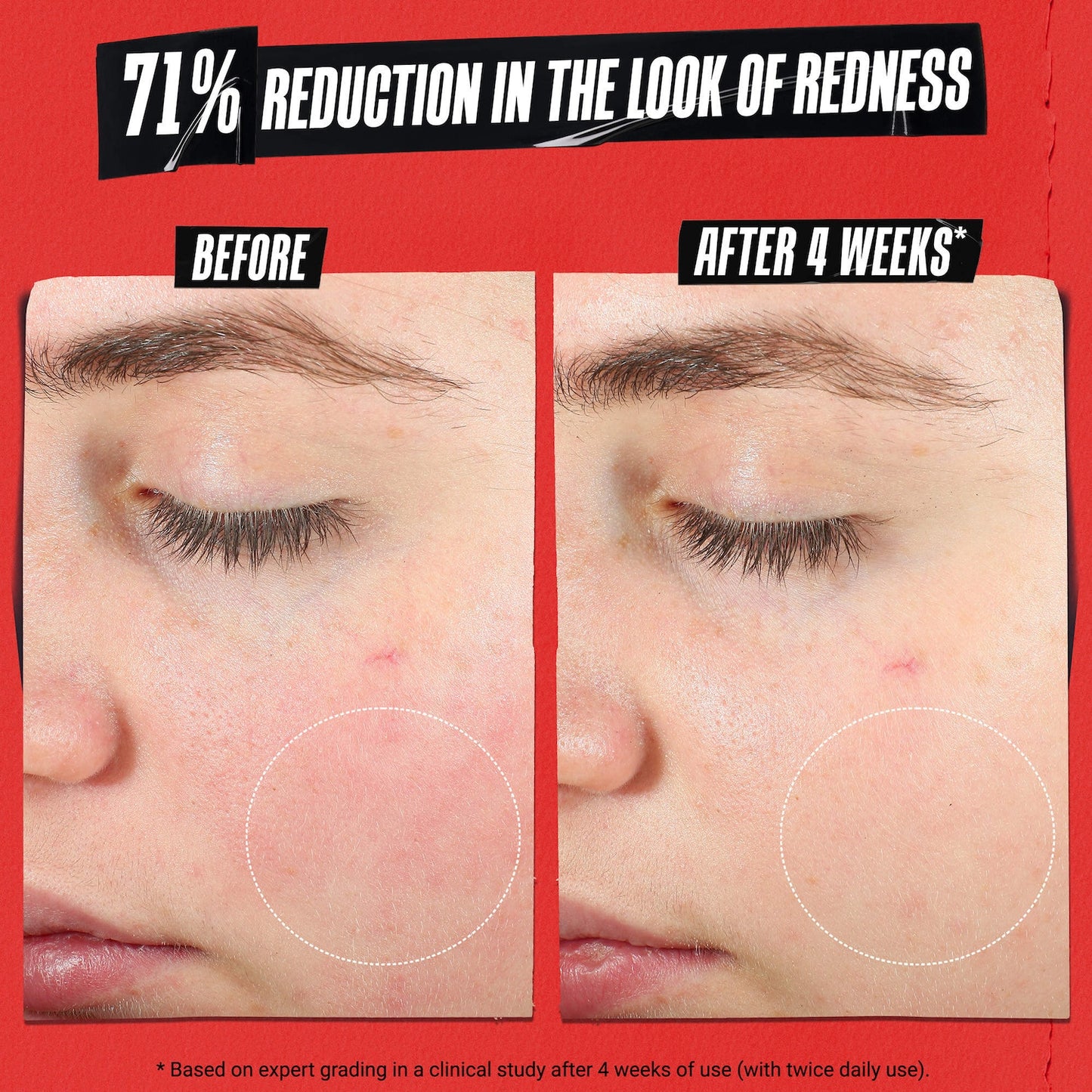 Kiehl's Since 1851 Ultra Facial Meltdown Recovery Dərmatoloji Krem Kolloidal Ovamalla