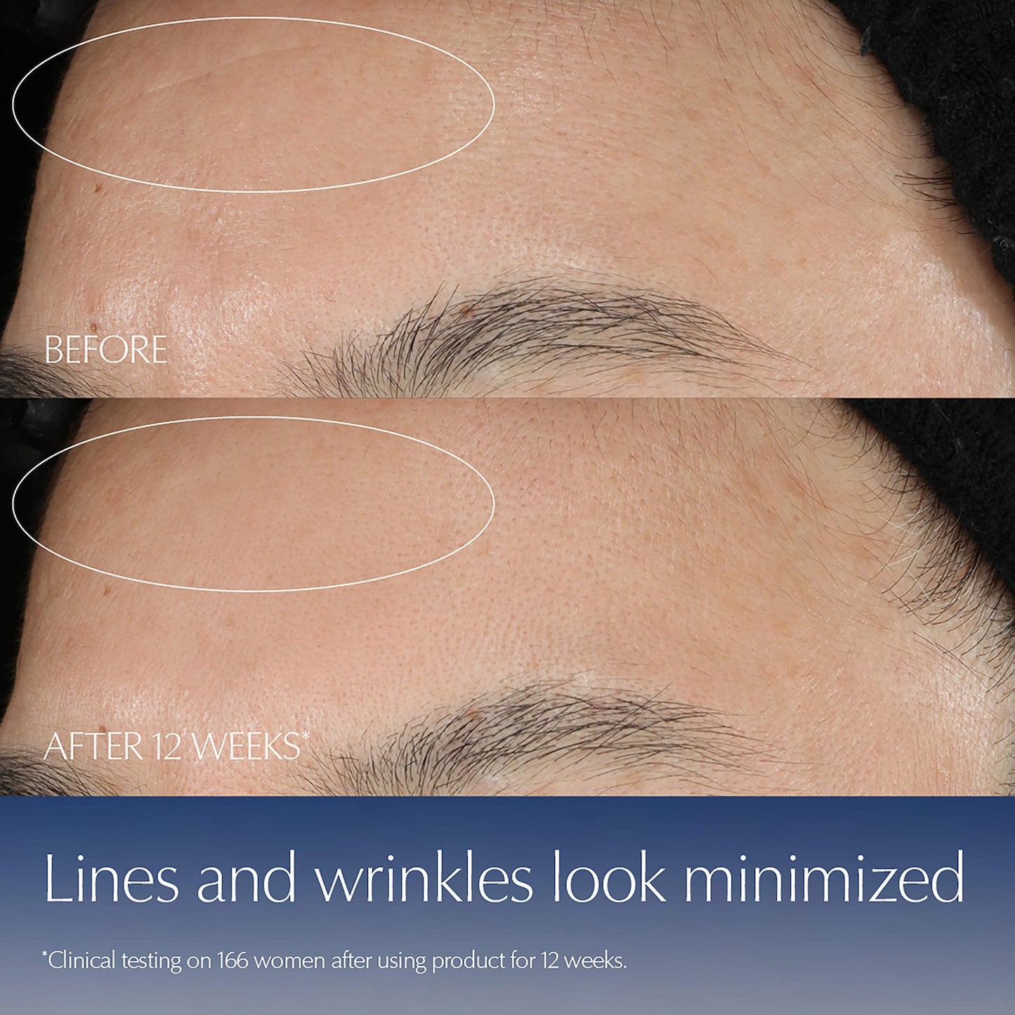 Estée Lauder Advanced Night Repair Üz və Göz Dərisinin Qorunması Dəsti