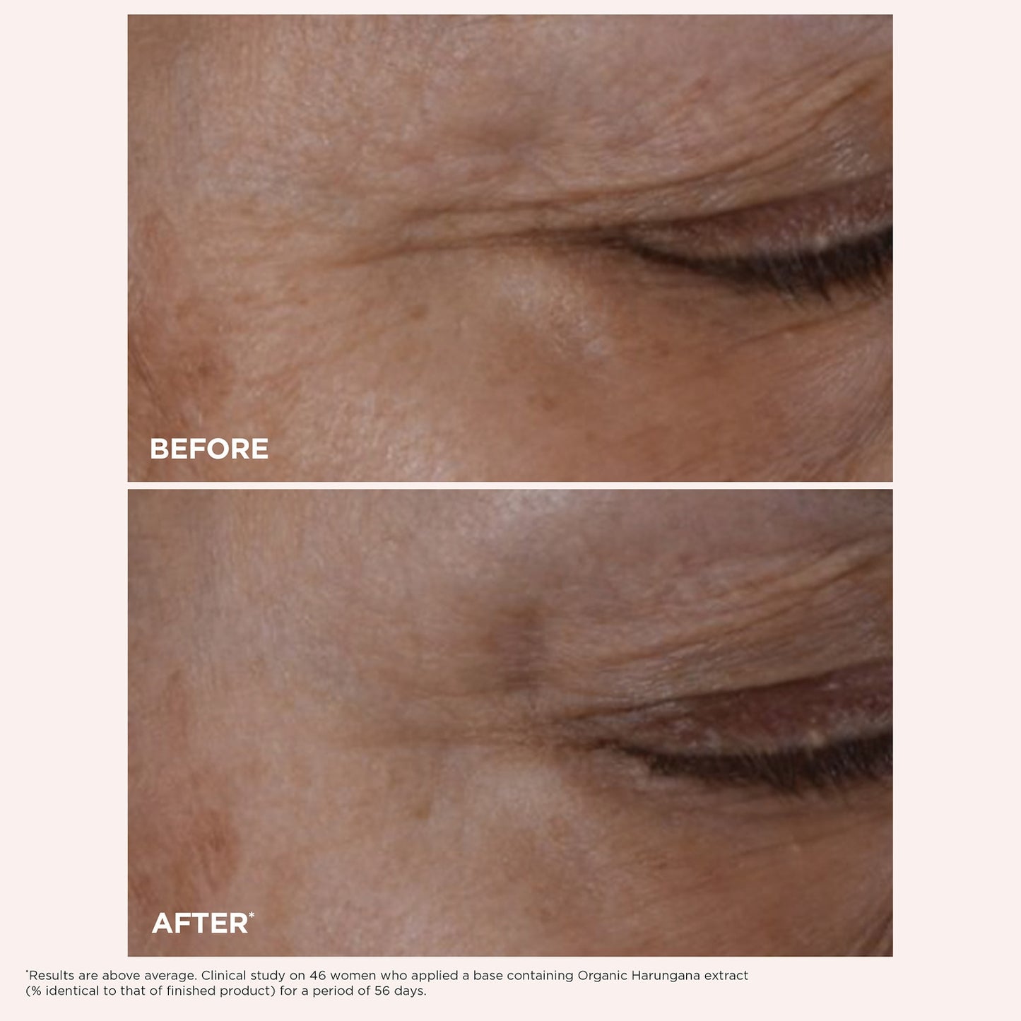 Clarins Total Eye Lift Göz Kremi - Səhvlik, Qırışqalar və Tünd Hələlər üçün