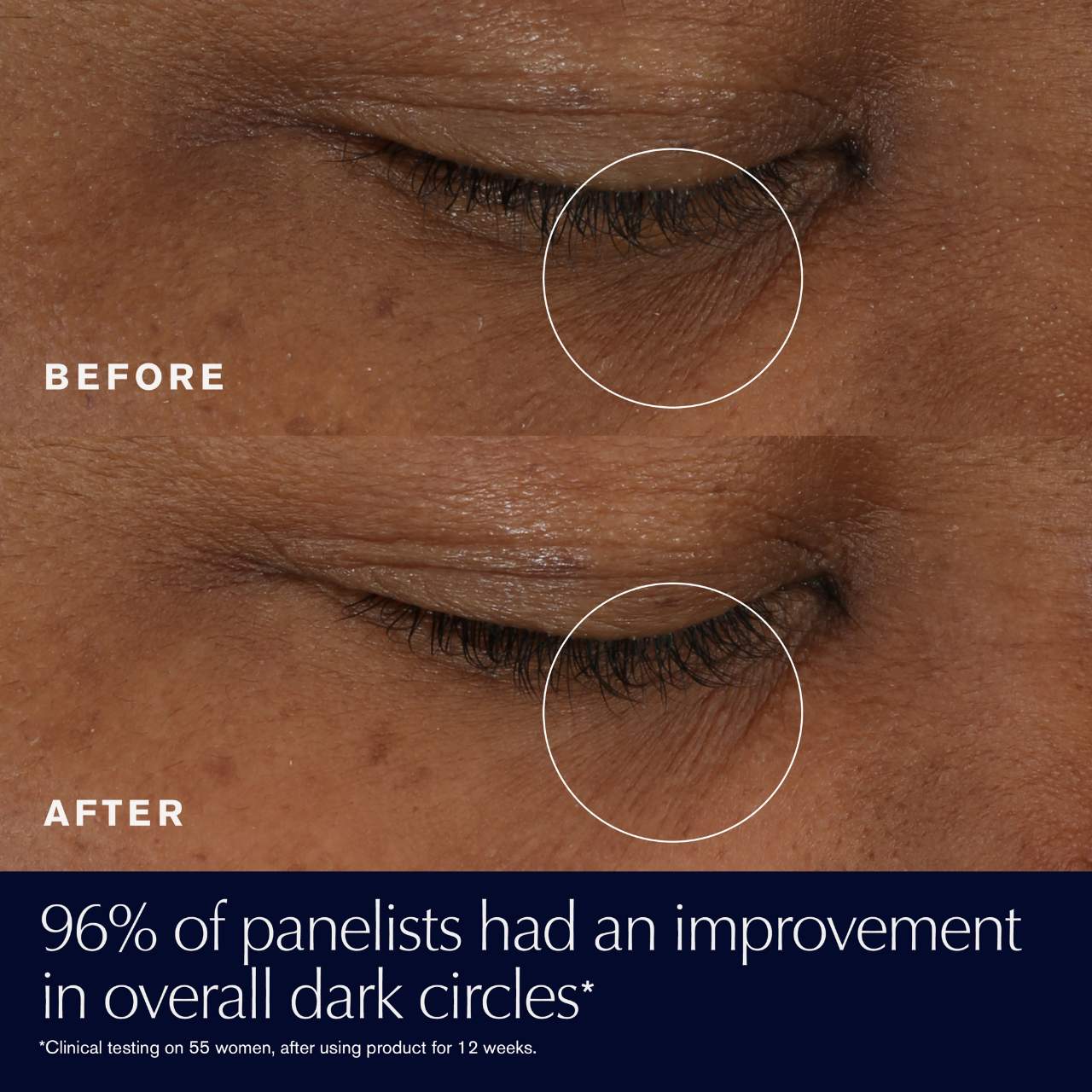 Estée Lauder Advanced Night Repair Eye Supercharged Gel Göz Kremi Hialuron Turşusu və E Vitamini ilə