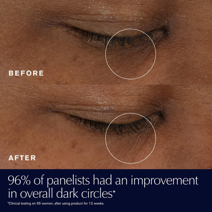 Estée Lauder Advanced Night Repair Eye Supercharged Gel Göz Kremi Hialuron Turşusu və E Vitamini ilə