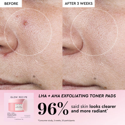 Glow Recipe Koreya Toner Pad Dəri Qulluğu Komplekti Gözenəklər, Tünd Ləkələr və Dəri Baryeri Onarışı üçün