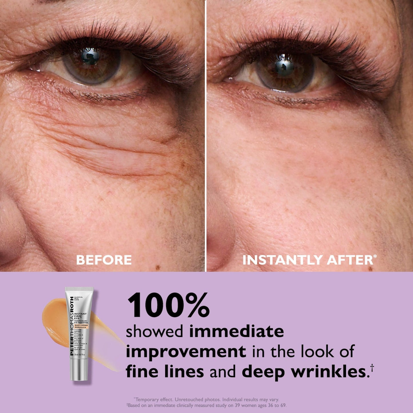 Peter Thomas Roth Instant FIRMx® Eye Göz Altı Sıkılaştırıcı Krem